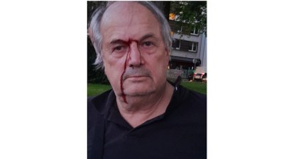 Brutale Polizeiattacke gegen Rechtsanwalt Roland Meister